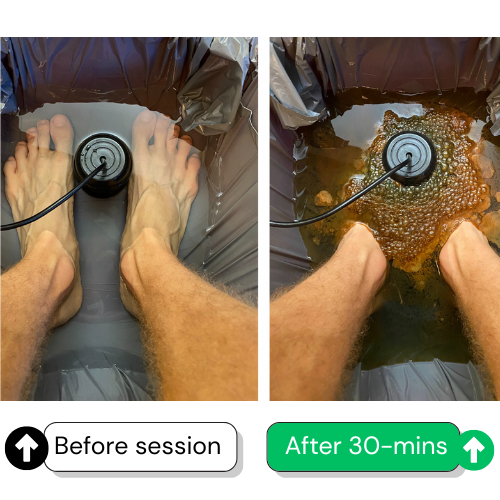 HeaWellness Ionic Foot Spa | Support your body’s natural detox